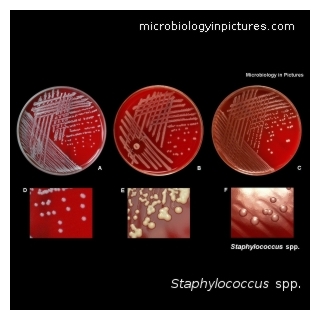 staphylococcus spp.